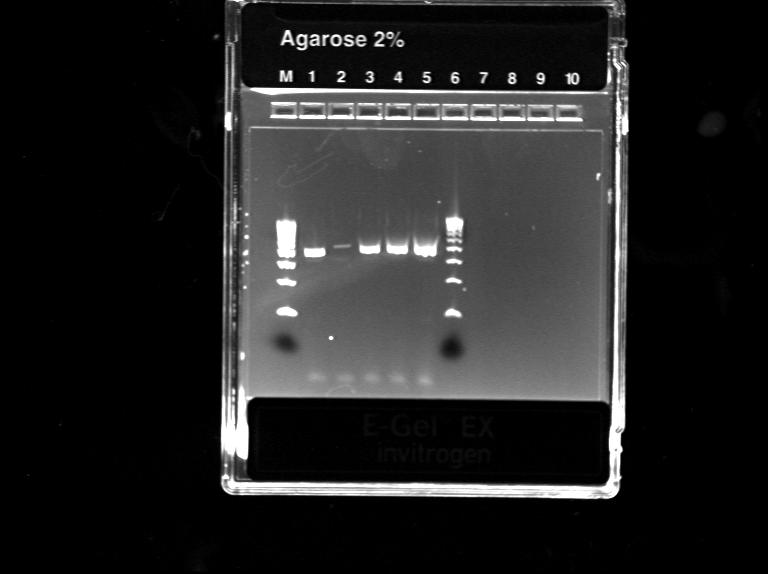 4.10. DEVETI PREIZKUS Odločili smo se, da bomo uporabili osnovni PCR protokol (opisan v metodah in načinih dela) za fragmente A, B, C in D (slike 19, 20 in 21).