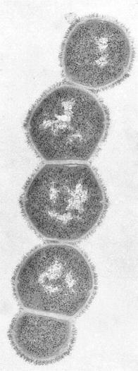 Streptococcus pyogenes (πυογόνος στρεπτόκοκκος) Α.