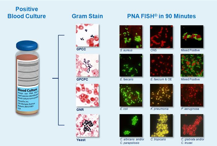 Fluorescence in situ hybridization (FISH) Nucleic-acid-based methods Probes hybridization Στόχος rrna: 16S rrna για βακτήρια 18S rrna για μύκητες Συνθετικά ολιγονουκλεοτίδια (probes) μονής έλικας