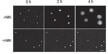 Multiplex Fluorescence in situ Hybridization (FISH) Assay and Automated Microscopy 1. Identification: specific probes (FISH assay) 2.