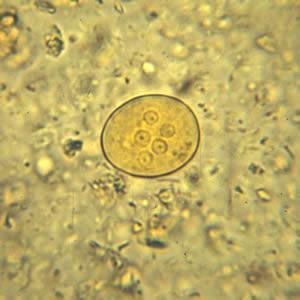 vizibili Chist Entamoeba hartmanni, col Lugol - Mai mic, 5-10 μm -
