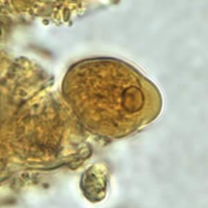Morfologie trofozoit (forma vegetativă) în intestinul gros diametru 10 40 µm mai alungit în scaunul diareic metabolism anaerob foarte mobil - pseudopod unic mare (= expansiune a mb