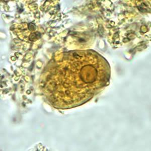 histolytica de E.