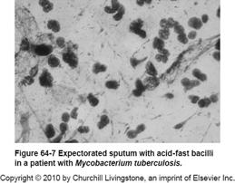 Mycobacterium tuberculosis Επιδημιολογία 14 x 10 6 νοσούν 1.