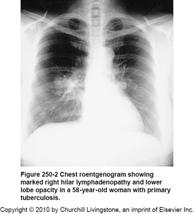 Πνευμονική ΤΒ Εισπνεόμενα σταγονίδια κυψελίδες