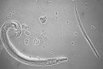 Hookworms Ancylostoma duodenale Necator americanus Α.