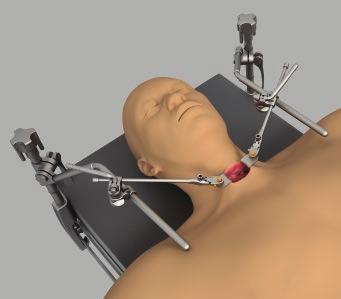 USER MANUAL / BILATERAL HEAD + NECK SET UP