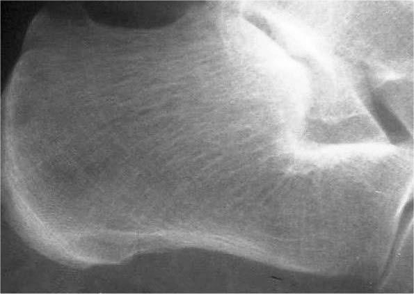 electromagnetice din domeniul spectral vizibil luminanţa.