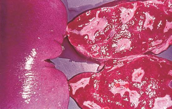 3. ΦΥΛΟ: ΠΛΑΤΥΕΛΜΙΝΘΕΣ (Platyhelminthes) - Ομοταξία/Κλάση: Τρηματώδεις Υφομοταξία/Υποκλάση: Διγενείς (Το παράδειγμα του Τρηματώδους του αίματος Schistosoma mansoni) Ήπαρ Ηπατικό πυλαίο σύστημα Ορθό