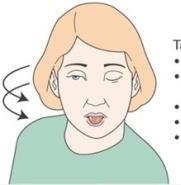 Παρκινσονισμός Σπασμός μυών γλώσσας, προσώπου, αυχένα, μιμικοί σπασμοί (όχι υστερικοί), βολβοστροφή