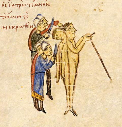 Από την είδηση ότι στην Κωνσταντινούπολη έγινε τον 10ο αιώνα μια εγχείρηση αποχωρισμού σιαμαίων παιδιών από την Αρμενία, τα οποία όμως δεν επέζησαν, μπορούμε να