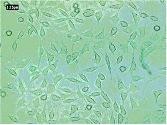 سپس محلول رویی از هر چاهک حذف و مقدار 00µl DMSO (دی متیل سولفواکسید فلوکا-آلمان) و µl بافر گلایسین- NaCl به هر چاهک افزوده شد و بلورهای فورمازان توسط سوسپانسیون بطور کامل حل شده و سرانجام جذب نوری