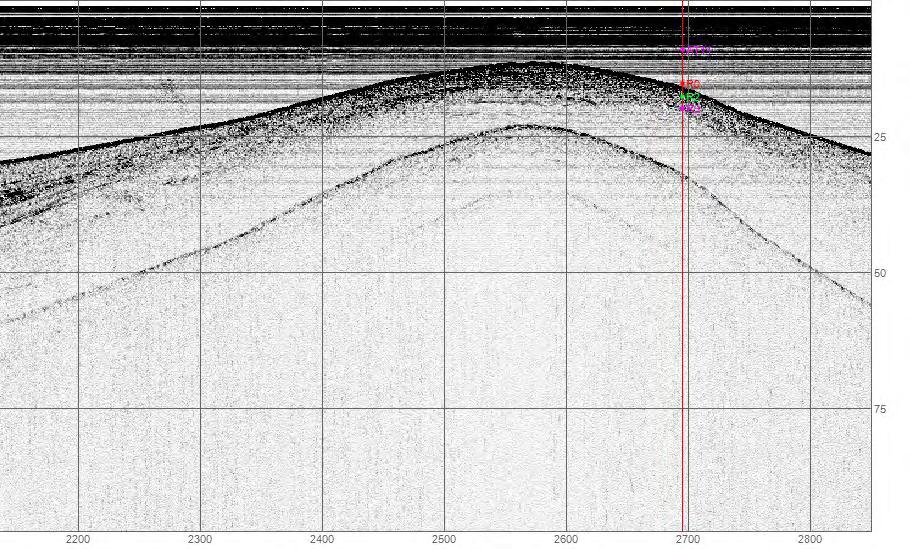 Τομογραφία όπου φαίνεται ο Ακουστικός Τύπος 7. Ο ακουστικός τύπος 8 παρατηρείται σχεδόν σε όλο τον κόλπο.