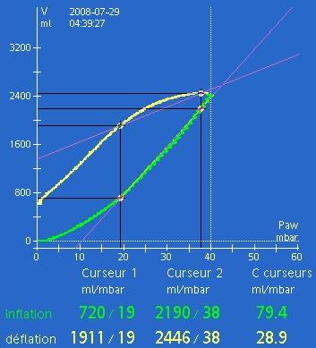 Tehnika počasna inflacija z konstantnim pretokom (low flow V-P loops) Grasso.