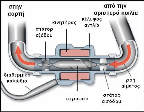 HeartMate II 3 η Γενεά