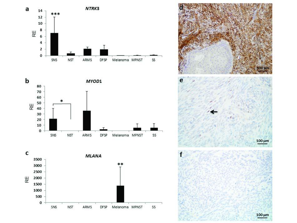 Supplementary Figure 4. Representative qpcr and immunohistochemistry studies confirm differential gene expression in SNS.