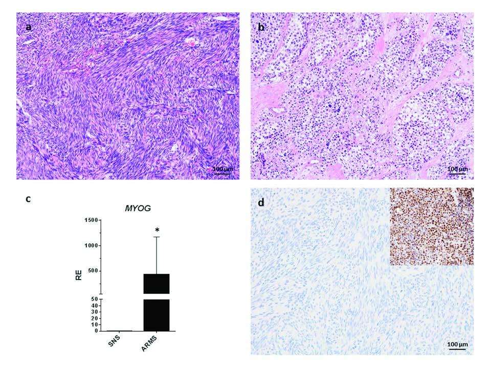 Supplementary Figure 5. Differential expression of myogenin between SNS and ARMS.