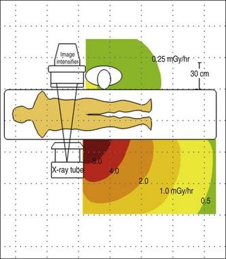 Schueler BA. Operator shielding: how and why.