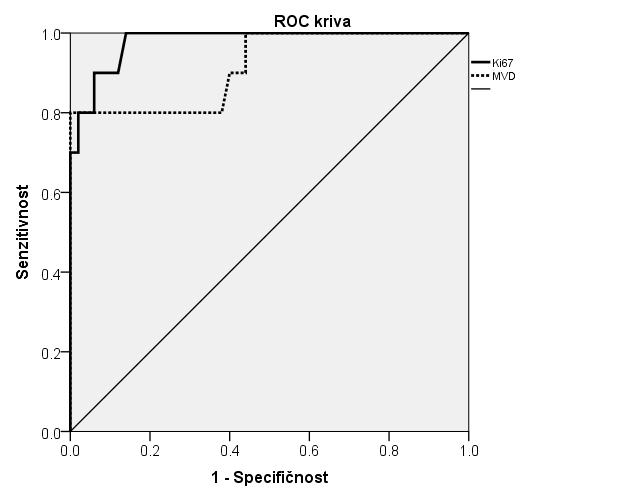 ROC крива Сензитивност 1 Специфичност Графикон 4 ROC криве зa Ki67 и MVD Ki67 > 511.54 Sn = 100,0 (69.0 100.0) Sp = 86.0 (73.3 94.2) MVD > 773.26 Sn = 80,0 (44.4 96.9) Sp = 100.0 (92.8 100.