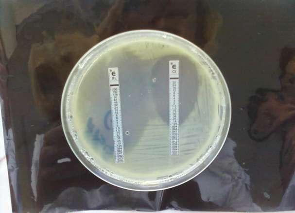Rezultate E-test pe mediu GC agar bază, completat cu 1% IsoVitaleX, fară hemoglobină;