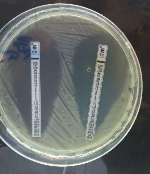 E-test pe mediu GC agar bază completat, cu 1% IsoVitaleX, fară hemoglobină;