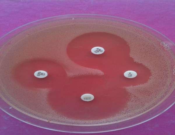 Antibiograma difuzimetrică pe mediu GC agar bază completat cu 1% IsoVitaleX, fără hemoglobină;