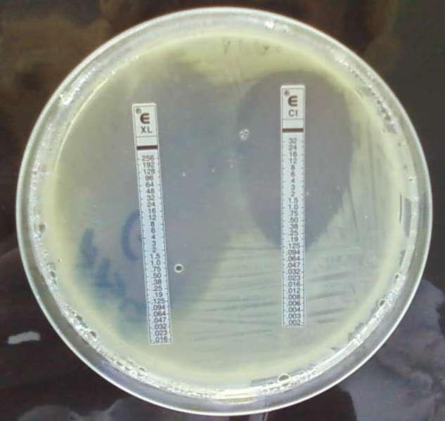 Rezultate E-test pe mediu GC agar bază, completat cu 1% IsoVitaleX, fară hemoglobină;