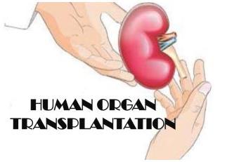 Επιλογή δότη στη μεταμόσχευση οργάνων Νεφρού
