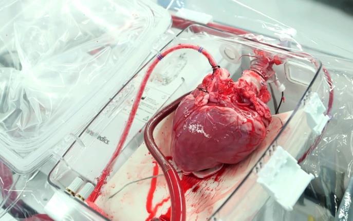Κριτήρια Κατανομής Θωρακικών Οργάνων ΑΒΟ ομάδα αίματος Σωματομετρικές διαστάσεις του λήπτη σε σχέση με το δότη Χρόνος αναμονής στη λίστα Δείκτης βαρύτητας της κατάστασης του λήπτη Πνεύμονας Καρδιά
