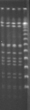 PFGE: type MSSA1. MLST: ST121 Ερωτήσεις: 1. Ήταν απαραίτητη η PFGE?? 2.