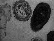 Nitrosomonas Predpona nitrozo