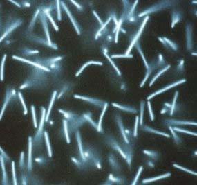 Metanogenci - Euryarcheota Značilni predstavniki: Methanobacterium Methanococcus Methanosarcina Pomembnejše lastnosti skupine: produkcija metana anoksigena okolja različna sestava celične stene