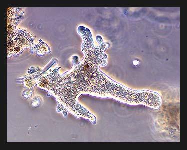 Amebe Značilni predstavniki: Amoeba