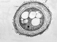 Azotobacter prostoživeči fiksator ne dela