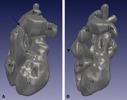 Figure 4 The Journal of Thoracic and Cardiovascular Surgery 2009 138, 571-580DOI: (10.1016/j.