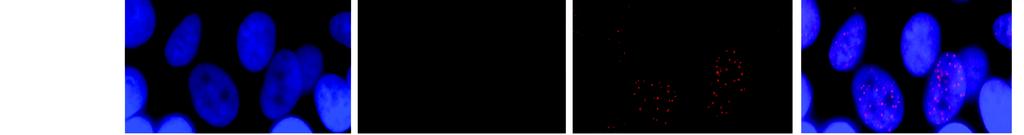 Immunofluorescence images of representative fields of MCF7 cells with si-control (sicon) cells or CDK12-silenced