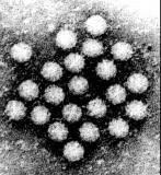 Astrovirus (27-30 nm) Sapovirus (27-35 nm)