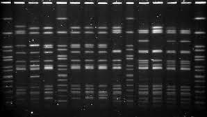 PFGE (Pulsed Field Gel Electrophoresis) Ένζυμα που κόβουν το χρωμόσωμα σε 20-25 κομμάτια, για να είναι πρακτικά δυνατή η σύγκριση των 2 μορίων Τα κομμάτια στα οποία