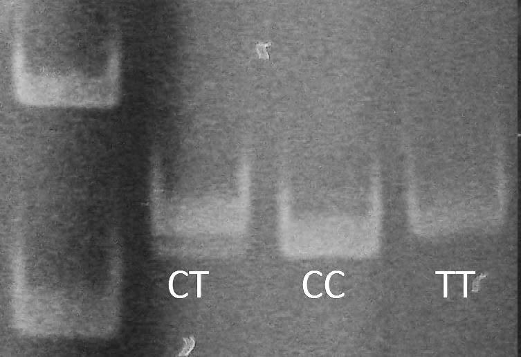 Испитаници и методе Драгана Стокановић Слика 5. Полиморфизми П-гликопротеина визуелизовани на полиакриламидном гелу 5.2.2.3.