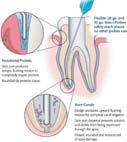 END-0036 ULTRADENT NaviTip Sideport 21-27mm 20 τεμάχια 35.95 END-0037 ULTRADENT NaviTip Sideport 21-27mm 50 τεμάχια 77.00 END-0038 ULTRADENT Skini σύριγγες 20 τεμάχια 11.