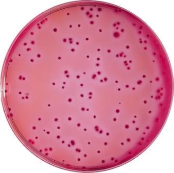 Εικόνα 2. Coliforms σε VRBA. agar Εικόνα 3.