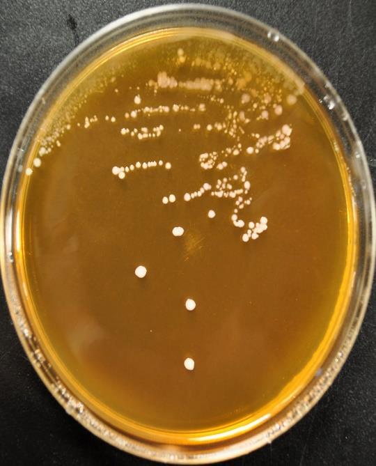 Το Lactobacillus Selective agar είναι εκλεκτικό για τα γένη Lactobacillus λόγου του όξινου ph που επιτυγχάνεται με την προσθήκη οξέος. Lactobacillus Selective agar Enzymatic Digest of Casein.