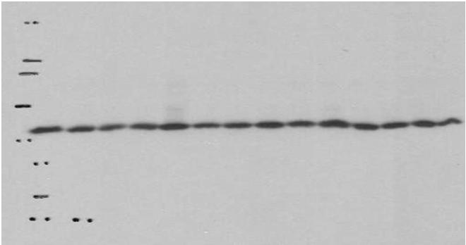 VEGFR3 P- β-actin 2 1