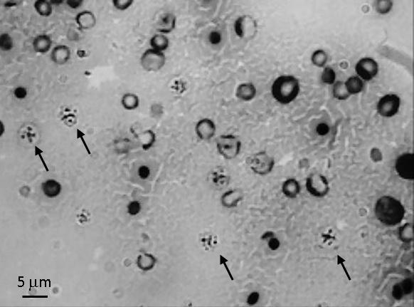 Pri nepohlavnom mnoţení sa mononukleárne trofozoity priľnuté k pneumocytom binárne delia (1) mitózou (2 3). Pri pohlavnom rozmnoţovaní sú prítomné trofozoity aj cysty.