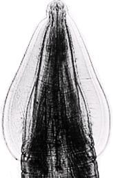 Vajíčka hlíst majú guľovitý aţ subsférický tvar (Obr. 101b). Veľkosť vajíčok je variabilná, u T. canis v rozmedzí od 72 82 µm, u T. cati 65 75 µm. Obal vajíčka je zloţený z chitínu.