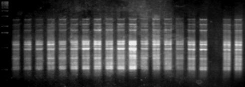 1 2 3 4 5 6 7 8 9 10 11 12 13 14 15 16 17 18 19 20 Εικόνα 36α: Ηλεκτροφόρηση των προϊόντων της PCR 20 διαφορετικών ατόμων (No. 1-20) C. sativus L.