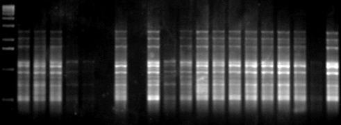 21 22 23 24 25 26 27 28 29 30 31 32 33 34 35 36 37 38 39 40 Εικόνα 36β: Ηλεκτροφόρηση των προϊόντων της PCR 20 διαφορετικών ατόμων (No. 21-40) C.