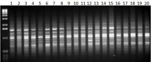 Εικόνα 38α: Ηλεκτροφόρηση των προϊόντων της PCR 20 διαφορετικών ατόμων (No. 1-20) C. sativus L.