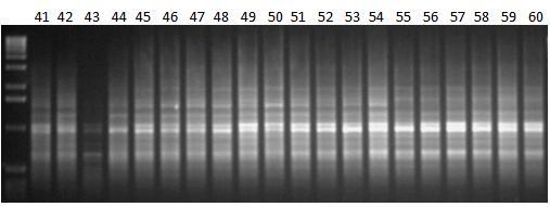 Εικόνα 38γ: Ηλεκτροφόρηση των προϊόντων της PCR 20 διαφορετικών ατόμων (No.