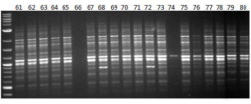 Εικόνα 38δ: Ηλεκτροφόρηση των προϊόντων της PCR 20 διαφορετικών ατόμων (No.